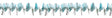 12" Teal Twist Garland